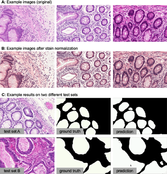 Figure 1 for MMV_Im2Im: An Open Source Microscopy Machine Vision Toolbox for Image-to-Image Transformation