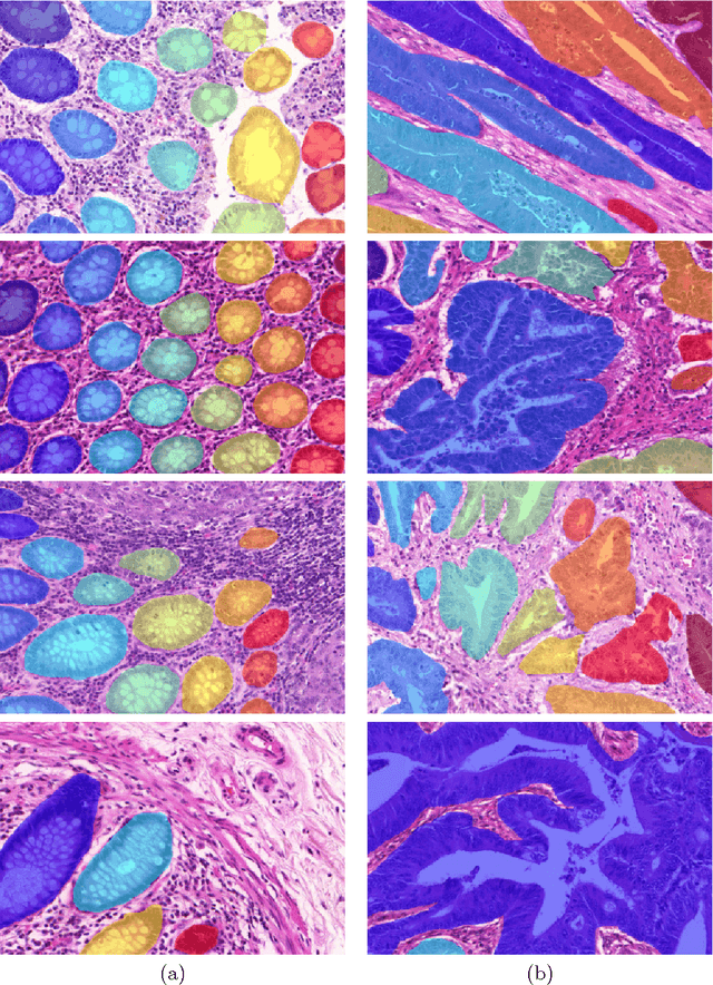 Figure 1 for Semantic Segmentation of Colon Glands with Deep Convolutional Neural Networks and Total Variation Segmentation