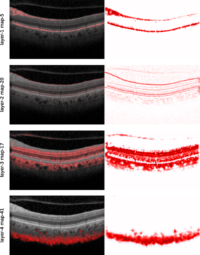 Figure 4 for Noise as Domain Shift: Denoising Medical Images by Unpaired Image Translation