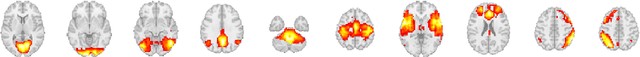 Figure 3 for Discovering Dynamic Functional Brain Networks via Spatial and Channel-wise Attention