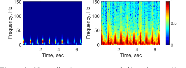 Figure 1 for Convolutional Recurrent Neural Networks for Electrocardiogram Classification