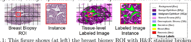 Figure 1 for Y-Net: Joint Segmentation and Classification for Diagnosis of Breast Biopsy Images