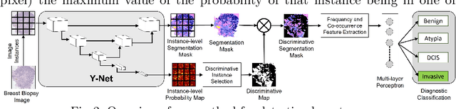 Figure 3 for Y-Net: Joint Segmentation and Classification for Diagnosis of Breast Biopsy Images