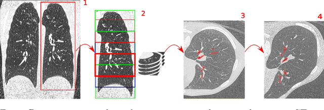 Figure 1 for Automatic Airway Segmentation in chest CT using Convolutional Neural Networks