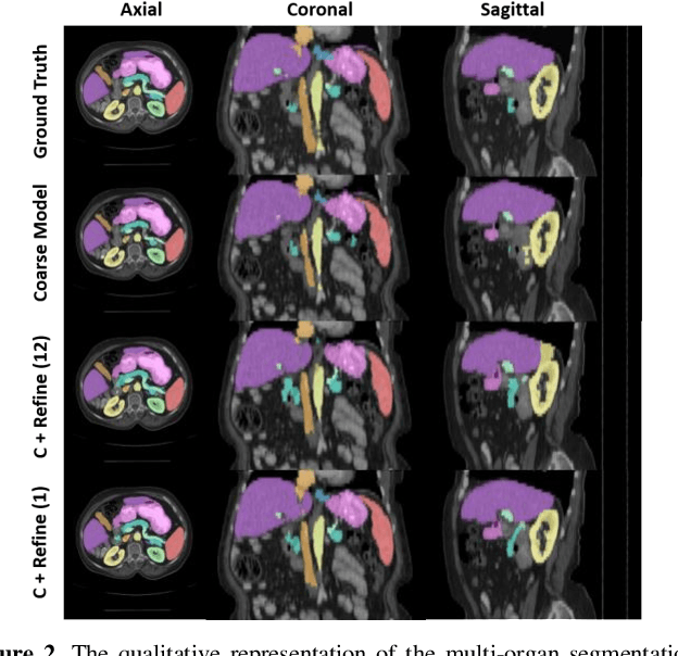 Figure 3 for RAP-Net: Coarse-to-Fine Multi-Organ Segmentation with Single Random Anatomical Prior