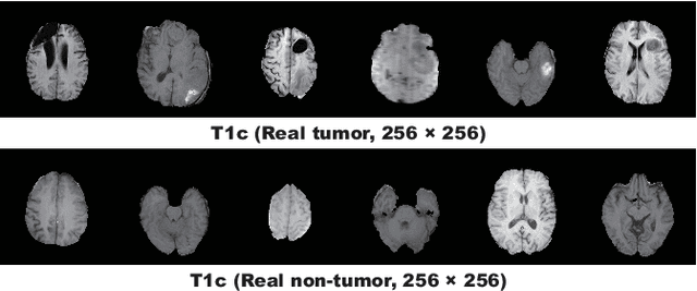 Figure 3 for Combining Noise-to-Image and Image-to-Image GANs: Brain MR Image Augmentation for Tumor Detection