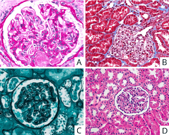 Figure 1 for Computational pathology in renal disease: a comprehensive perspective