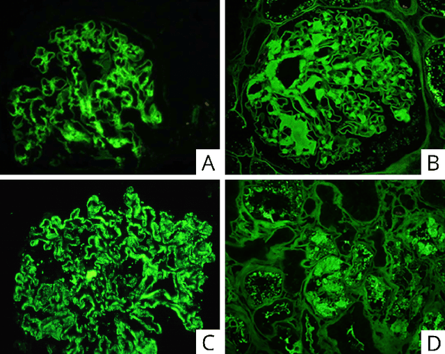 Figure 2 for Computational pathology in renal disease: a comprehensive perspective