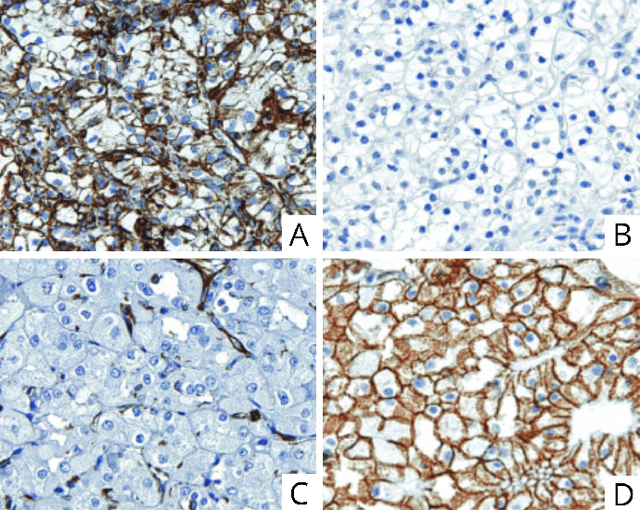 Figure 3 for Computational pathology in renal disease: a comprehensive perspective