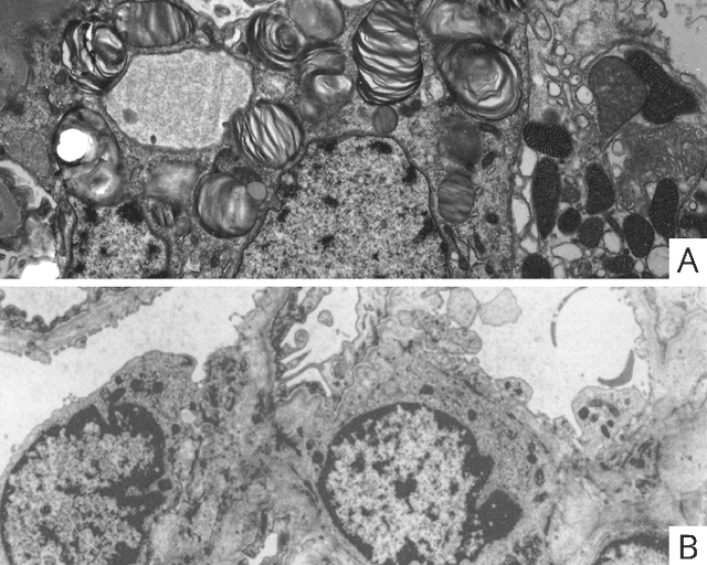 Figure 4 for Computational pathology in renal disease: a comprehensive perspective