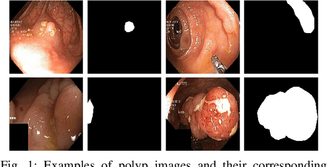 Figure 1 for ResUNet++: An Advanced Architecture for Medical Image Segmentation