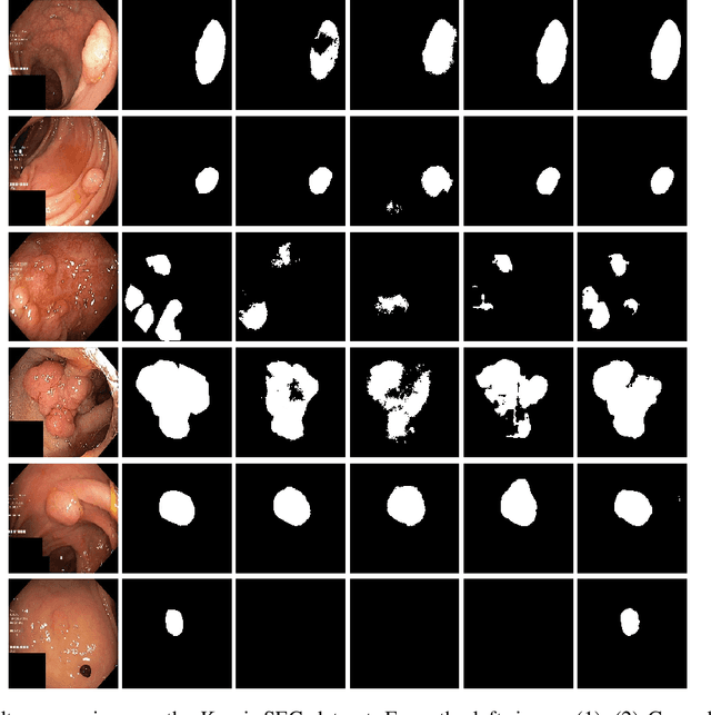 Figure 3 for ResUNet++: An Advanced Architecture for Medical Image Segmentation