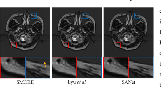 Figure 1 for Exploring Separable Attention for Multi-Contrast MR Image Super-Resolution