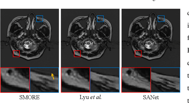Figure 1 for Exploring Separable Attention for Multi-Contrast MR Image Super-Resolution