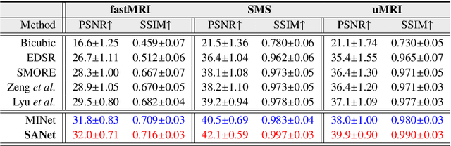 Figure 2 for Exploring Separable Attention for Multi-Contrast MR Image Super-Resolution