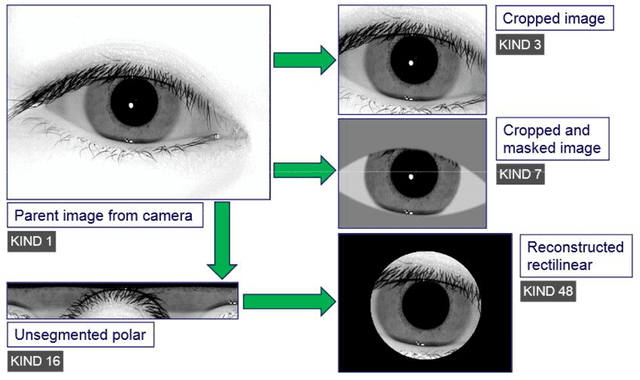 Figure 1 for Cross-Sensor Iris Recognition: LG4000-to-LG2200 Comparison