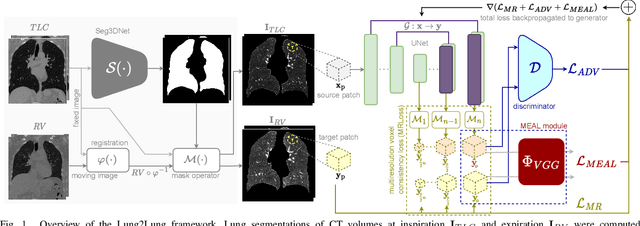Figure 1 for Lung2Lung: Volumetric Style Transfer with Self-Ensembling for High-Resolution Cross-Volume Computed Tomography