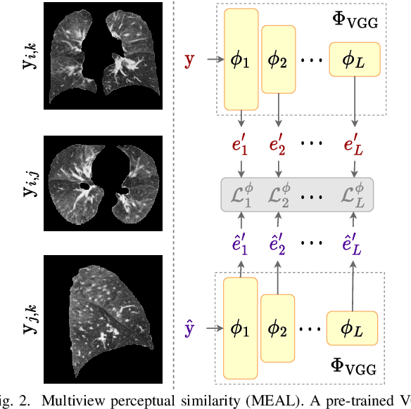 Figure 3 for Lung2Lung: Volumetric Style Transfer with Self-Ensembling for High-Resolution Cross-Volume Computed Tomography