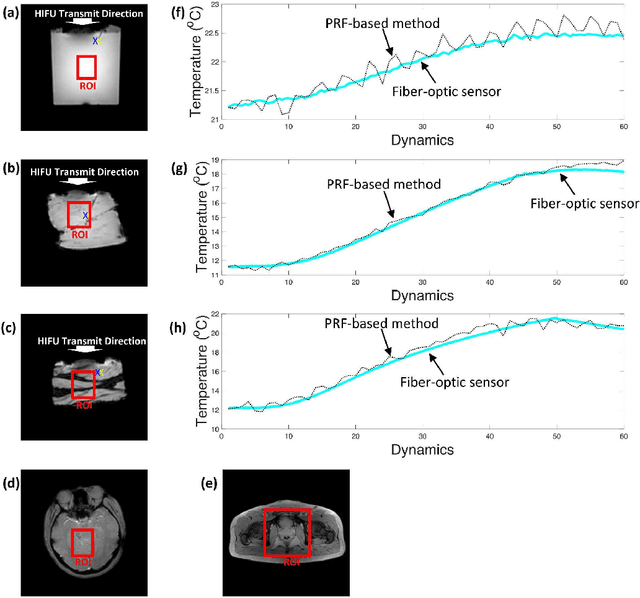 Figure 4 for Real-time interactive magnetic resonance (MR) temperature imaging in both aqueous and adipose tissues using cascaded deep neural networks for MR-guided focused ultrasound surgery (MRgFUS)