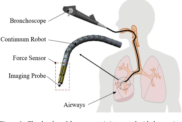 Figure 1 for FBG-Based Triaxial Force Sensor Integrated with an Eccentrically Configured Imaging Probe for Endoluminal Optical Biopsy