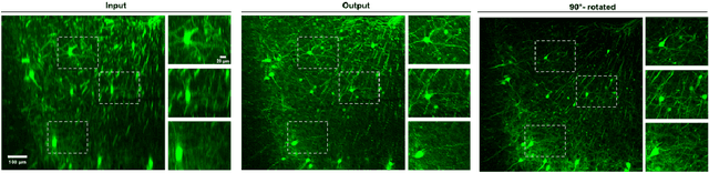 Figure 2 for Axial-to-lateral super-resolution for 3D fluorescence microscopy using unsupervised deep learning