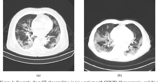 Figure 1 for COVIDNet-CT: A Tailored Deep Convolutional Neural Network Design for Detection of COVID-19 Cases from Chest CT Images