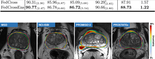 Figure 4 for Federated Cross Learning for Medical Image Segmentation