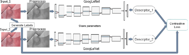 Figure 3 for Combining Deep Learning with Geometric Features for Image based Localization in the Gastrointestinal Tract