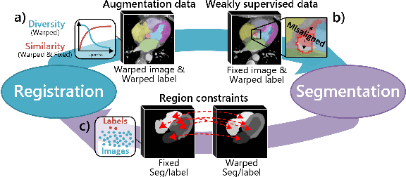 Figure 1 for Deep Complementary Joint Model for Complex Scene Registration and Few-shot Segmentation on Medical Images