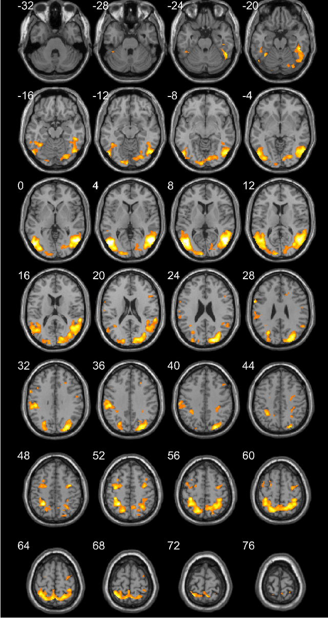 Figure 2 for Multisubject Task-Related fMRI Data Processing via a Two-Stage Generalized Canonical Correlation Analysis
