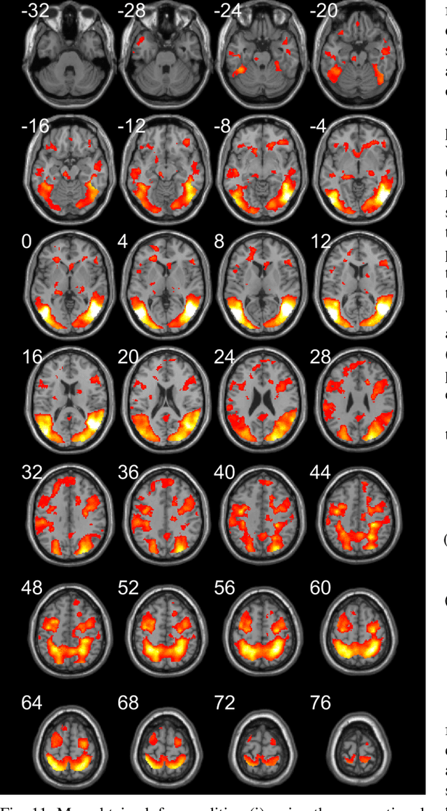 Figure 3 for Multisubject Task-Related fMRI Data Processing via a Two-Stage Generalized Canonical Correlation Analysis