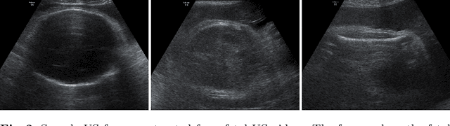 Figure 3 for BabyNet: Residual Transformer Module for Birth Weight Prediction on Fetal Ultrasound Video