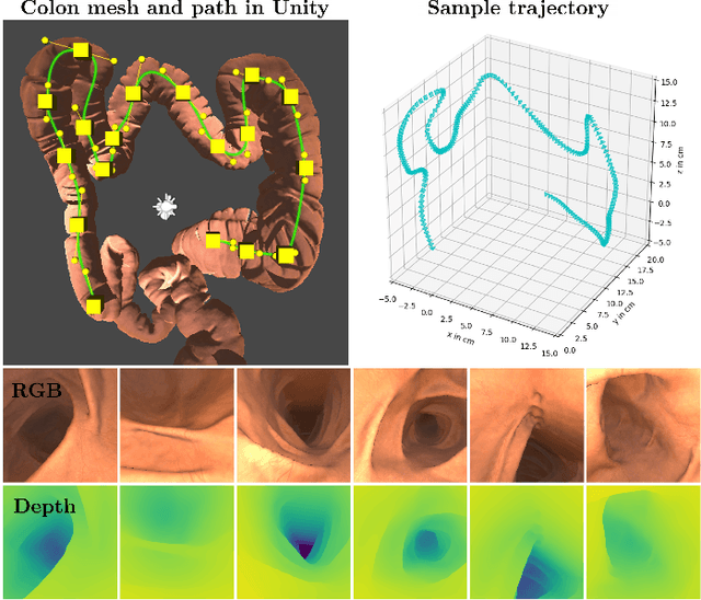 Figure 1 for Bimodal Camera Pose Prediction for Endoscopy