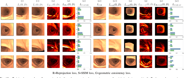 Figure 2 for Bimodal Camera Pose Prediction for Endoscopy