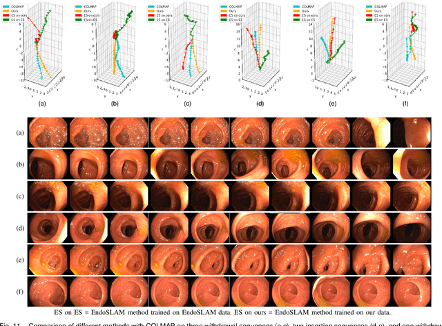 Figure 3 for Bimodal Camera Pose Prediction for Endoscopy