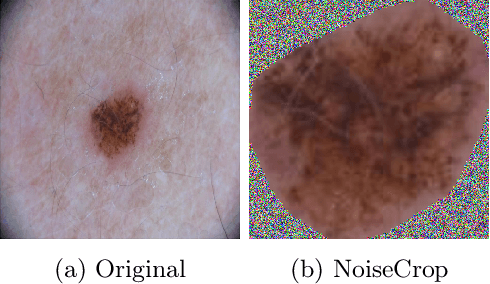 Figure 3 for Artifact-Based Domain Generalization of Skin Lesion Models