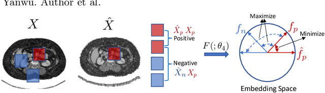 Figure 3 for Adversarial Consistency for Single Domain Generalization in Medical Image Segmentation