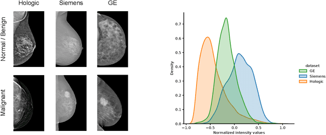 Figure 1 for Memory-aware curriculum federated learning for breast cancer classification