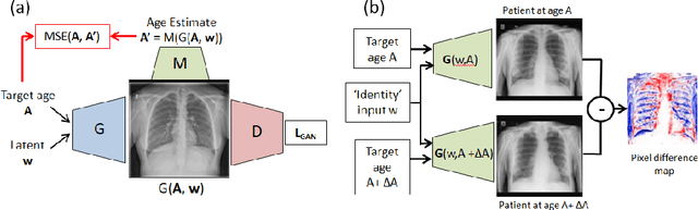 Figure 1 for Assessing the Performance of Automated Prediction and Ranking of Patient Age from Chest X-rays Against Clinicians