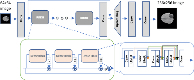 Figure 1 for Single MR Image Super-Resolution using Generative Adversarial Network