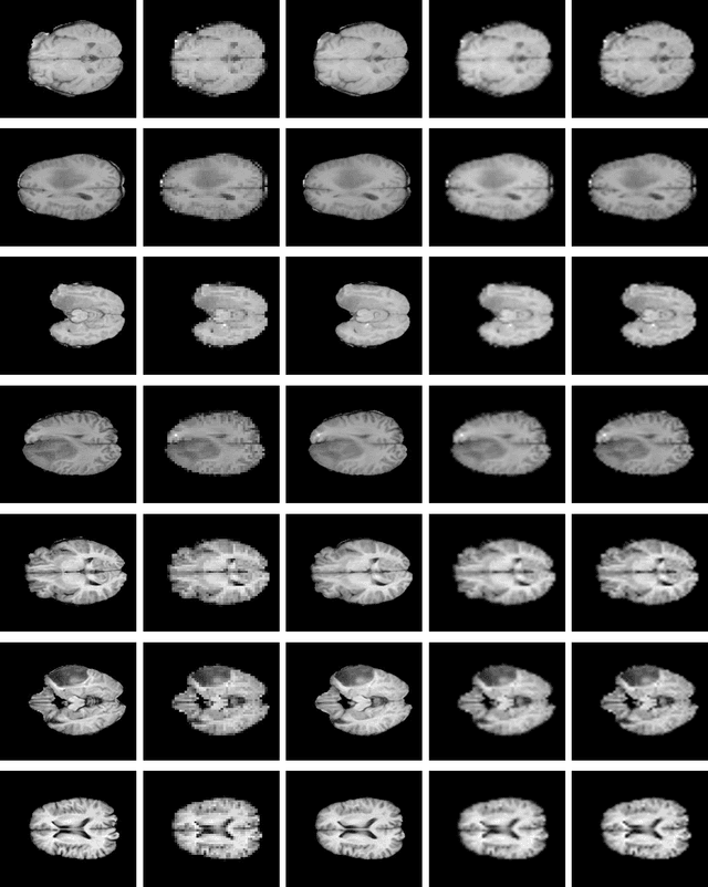 Figure 4 for Single MR Image Super-Resolution using Generative Adversarial Network