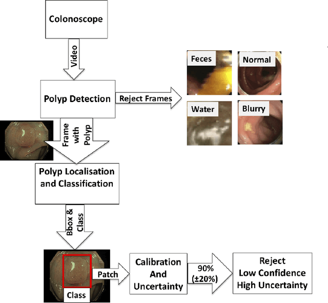 Figure 1 for Detecting, Localising and Classifying Polyps from Colonoscopy Videos using Deep Learning