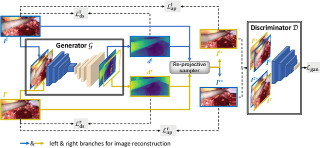 Figure 1 for Self-Supervised Generative Adversarial Network for Depth Estimation in Laparoscopic Images