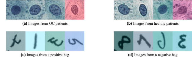 Figure 1 for Oral cancer detection and interpretation: Deep multiple instance learning versus conventional deep single instance learning