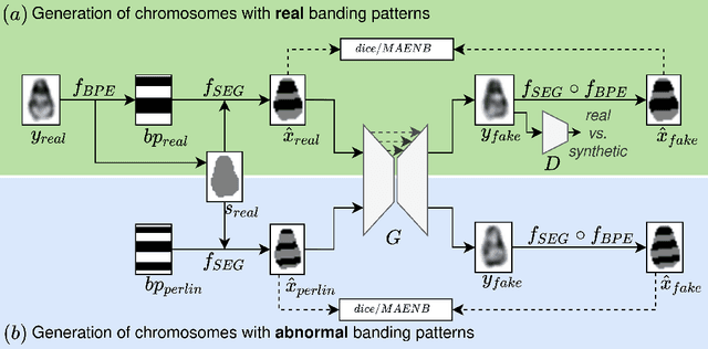 Figure 1 for Deep Anomaly Generation: An Image Translation Approach of Synthesizing Abnormal Banded Chromosome Images