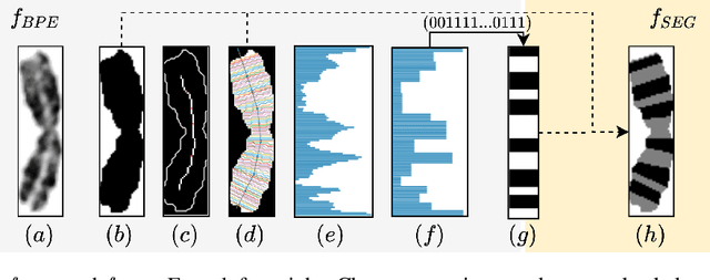 Figure 2 for Deep Anomaly Generation: An Image Translation Approach of Synthesizing Abnormal Banded Chromosome Images