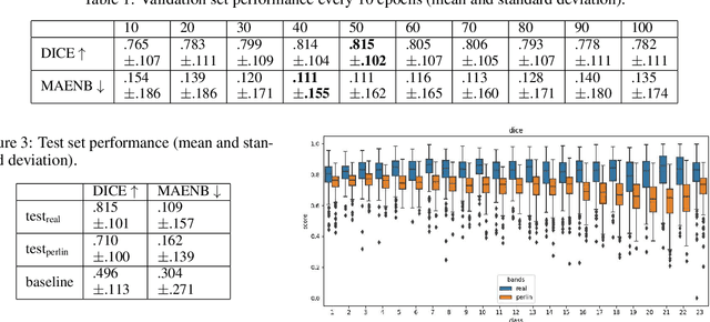 Figure 3 for Deep Anomaly Generation: An Image Translation Approach of Synthesizing Abnormal Banded Chromosome Images