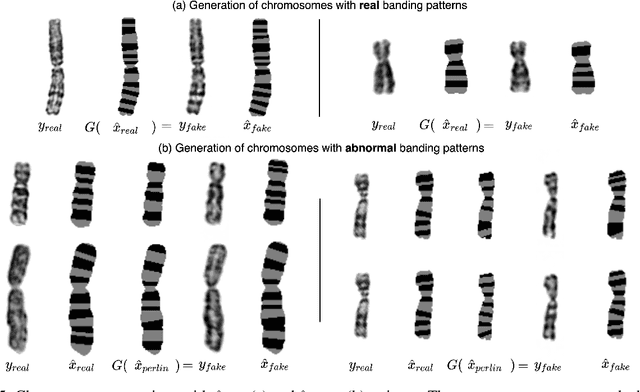 Figure 4 for Deep Anomaly Generation: An Image Translation Approach of Synthesizing Abnormal Banded Chromosome Images
