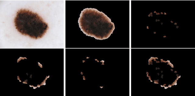 Figure 1 for TATL: Task Agnostic Transfer Learning for Skin Attributes Detection