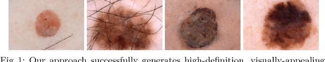 Figure 1 for Skin Lesion Synthesis with Generative Adversarial Networks